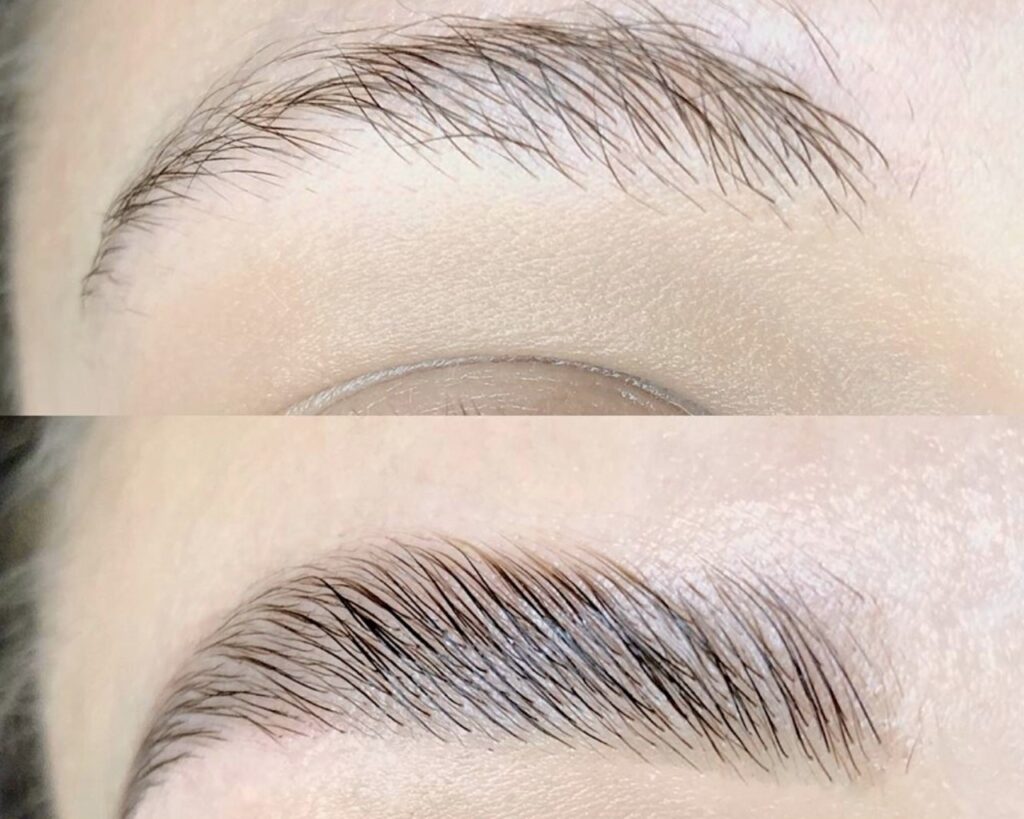 Eyebrow before and after